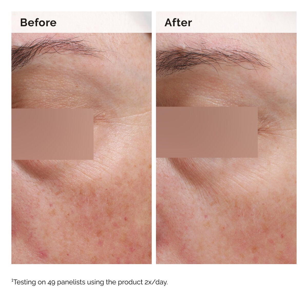 niacinamide-5-face-and-body-emulsion-o0 2024-08-23-ORD-Nia-5pct-Face-Body-B-A-Elasticity-Global-02-1x1.jpg