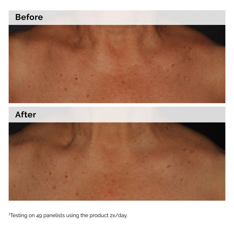 niacinamide-5-face-and-body-emulsion-o0 2024-08-23-ORD-Nia-5pct-Face-Body-B-A-Global-02-1x1.jpg