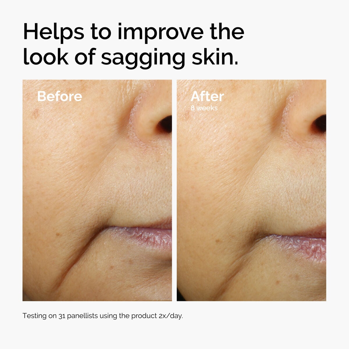 caffeine-3-escin-1-face-serum-j8 ord-caffeine-3pct-escin-1pct-face-serum-before-after-sagging.jpg