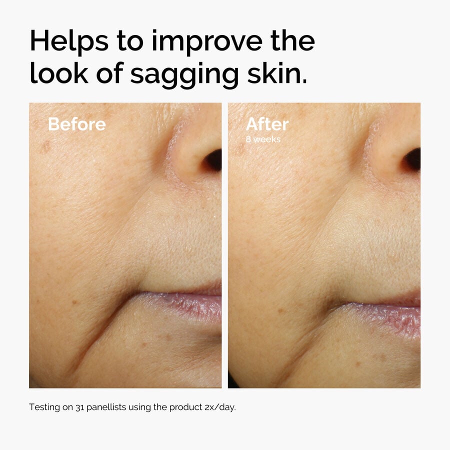 caffeine-3-escin-1-face-serum-j8 ord-caffeine-3pct-escin-1pct-face-serum-before-after-sagging.jpg
