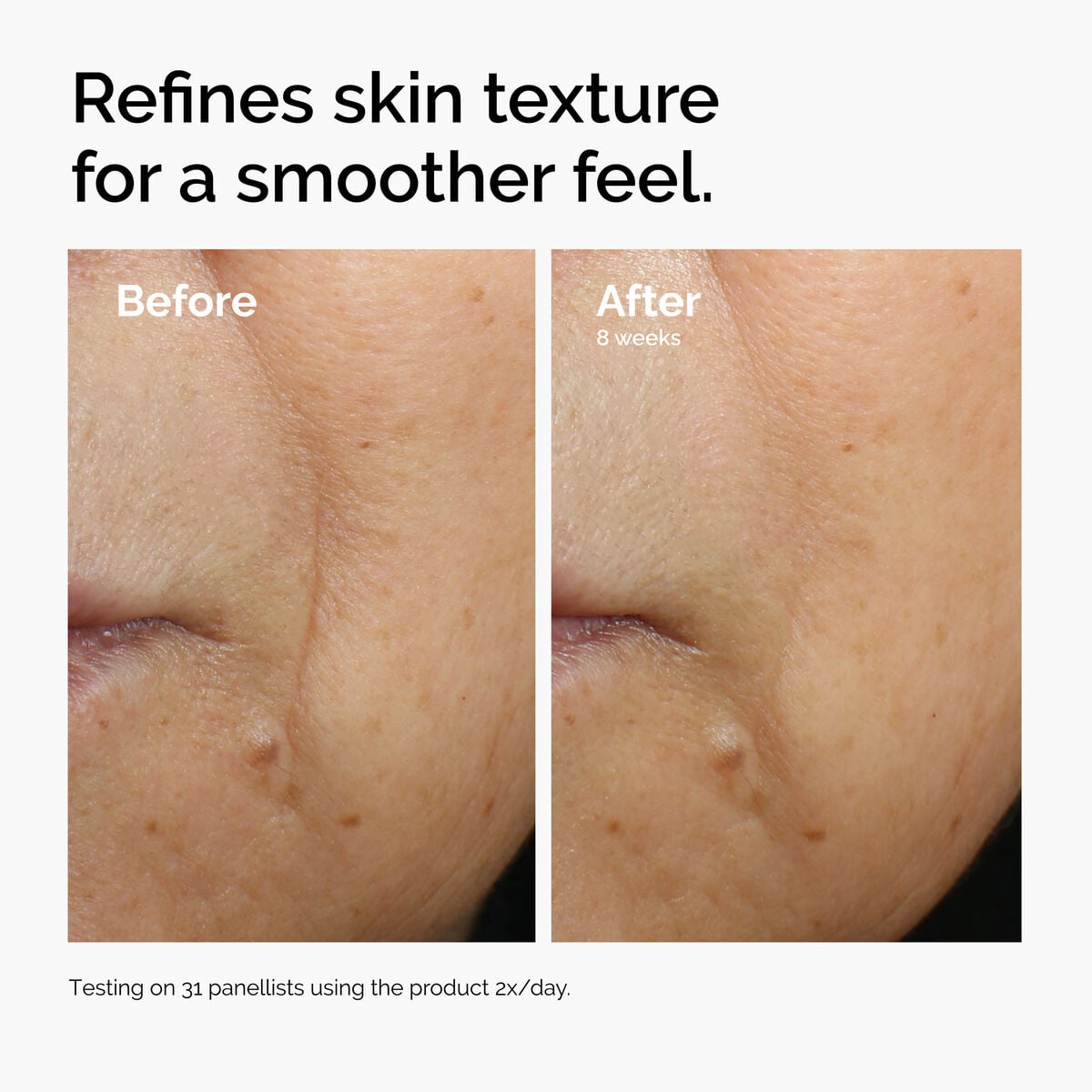 caffeine-3-escin-1-face-serum-j8 ord-caffeine-3pct-escin-1pct-face-serum-before-after-texture.jpg