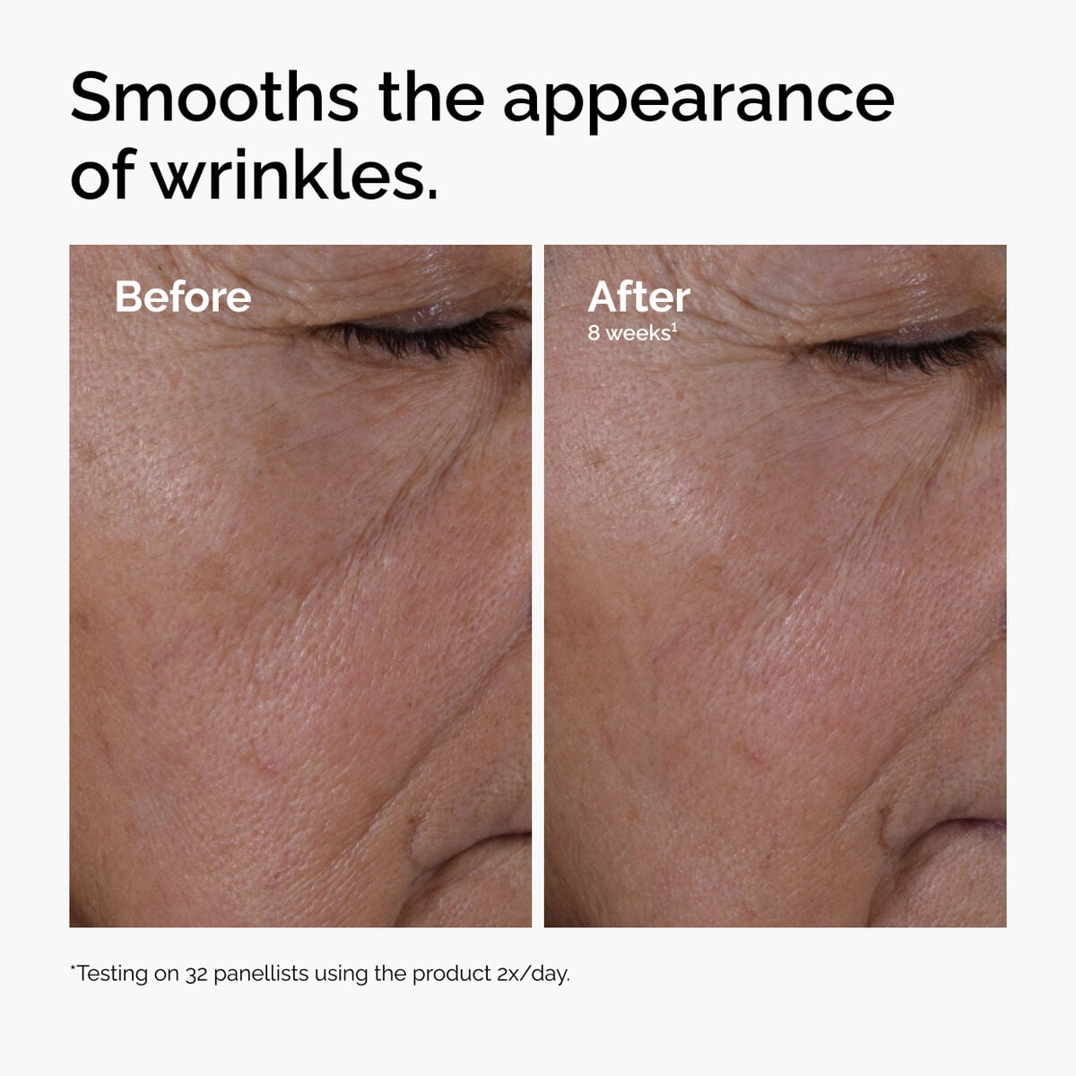 multi-peptide-ha-serum-q6 ord-multi-peptide-ha-serum-wrinkles-before-after.jpg