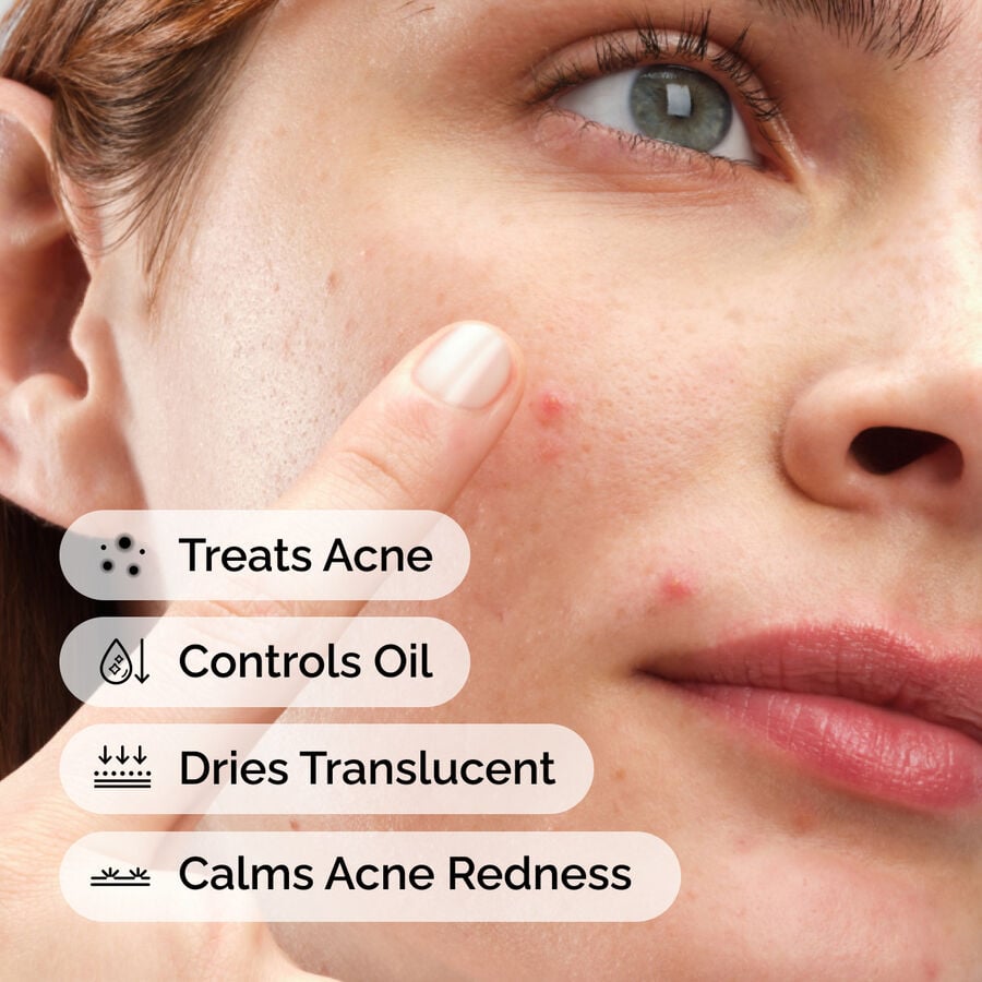 sulfur-10-powder-to-cream-concentrate-b4 ord-sulfur-10pct-powder-to-cream-concentrate-model-application-with-benefits-acne.jpg